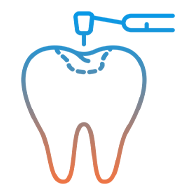 Tooth Fillings