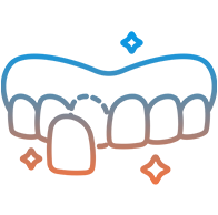 Veneers